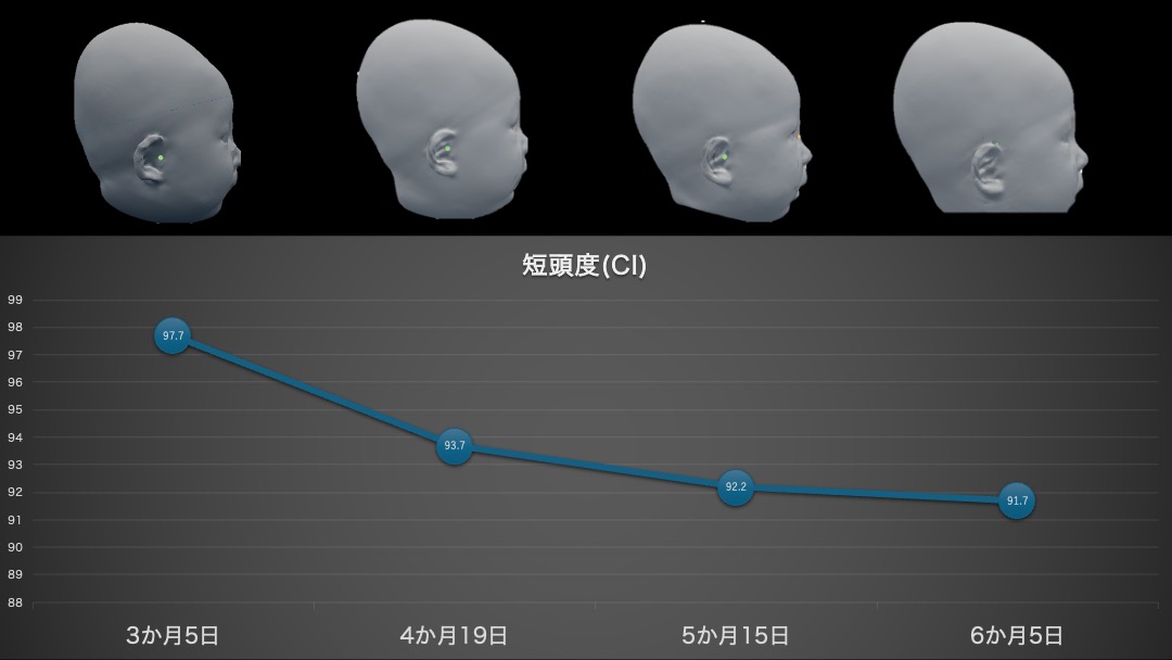 短頭症治療例
