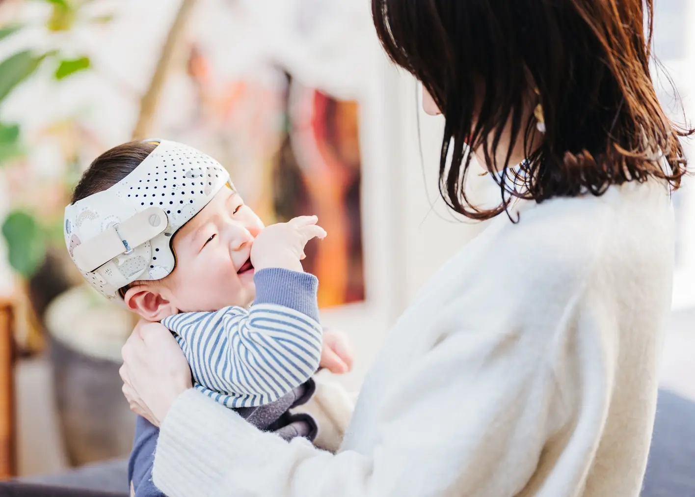 ヘルメット治療している赤ちゃんの画像
