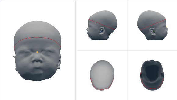 頭部のスキャン画像